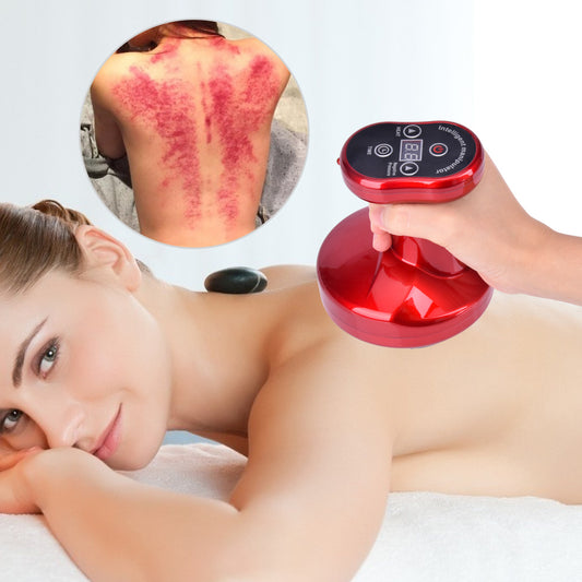 Electric Cupping Stimulate Acupoint Body Slimming Massager