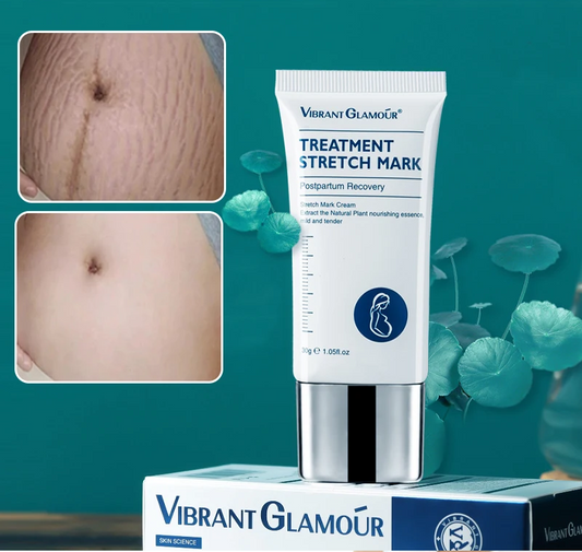 VIBRANT GLAMOUR stretch mark cream