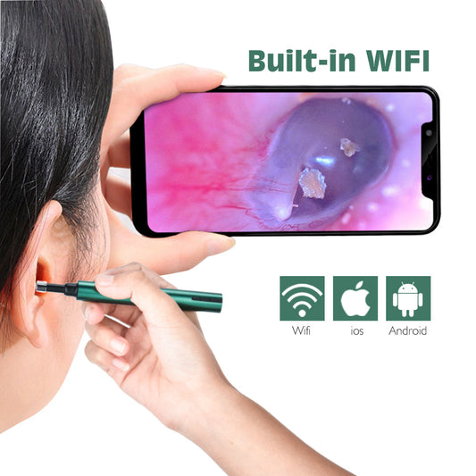 Wireless WiFi Ear Pick Otoscope Camera