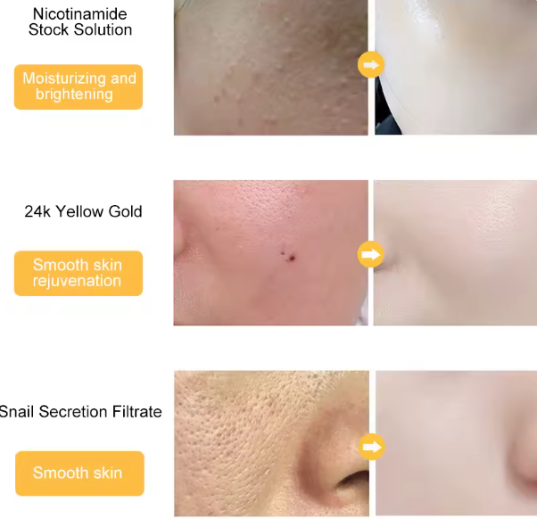 24k Gold Essence shrinks large pores and repairs for (female and male )