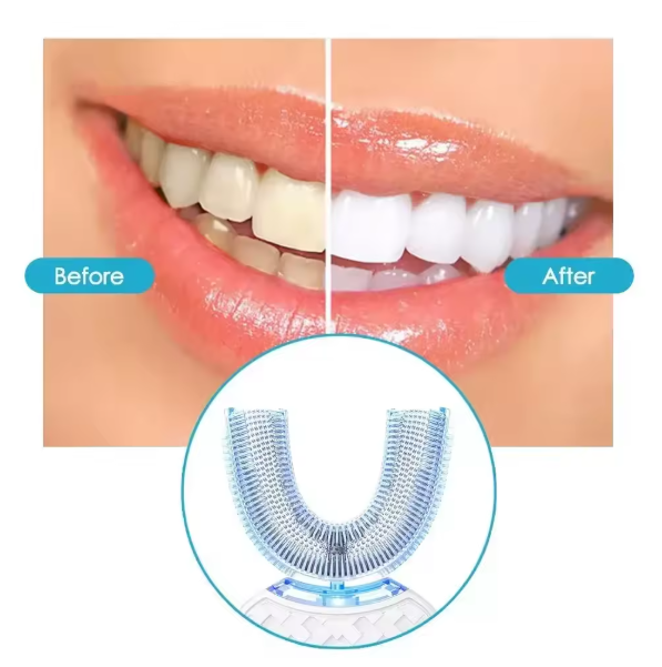 New Automatic Toothbrush U-Shape Full Mouth 360° Clean Teeth Whitening IPX7 Waterproof